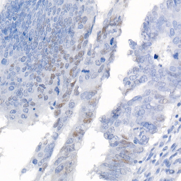 CDKN1A/p21CIP1 Rabbit mAb