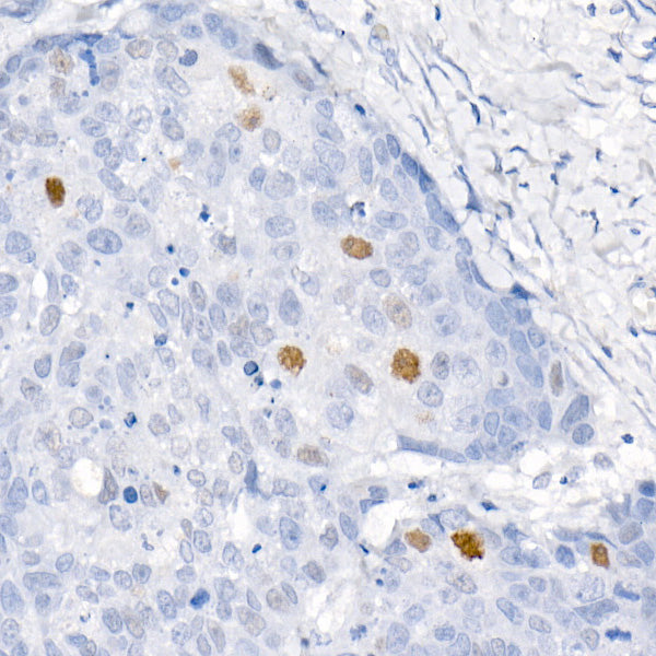 CDKN1A/p21CIP1 Rabbit mAb