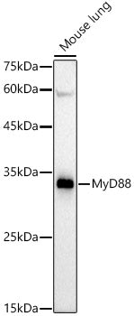 MyD88 Rabbit mAb