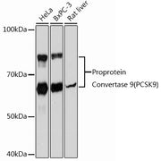 Proprotein Convertase 9(PCSK9) Rabbit mAb