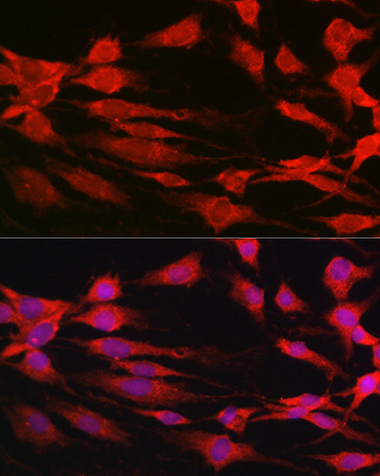 p70 S6 Kinase 1 Rabbit pAb