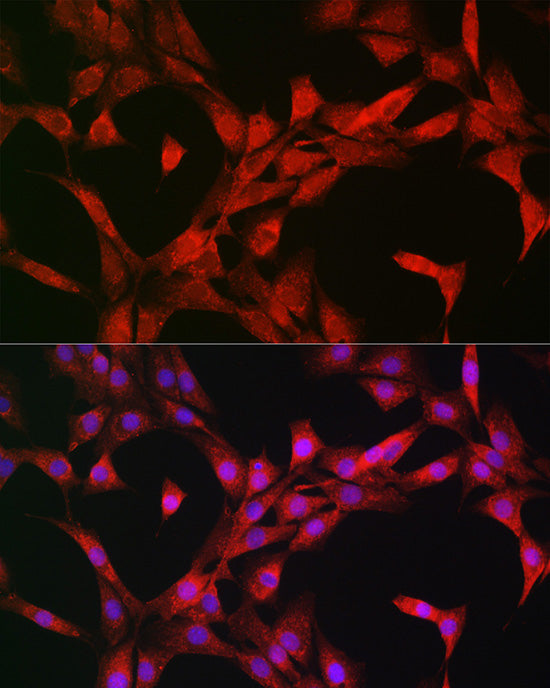 p70 S6 Kinase 1 Rabbit pAb