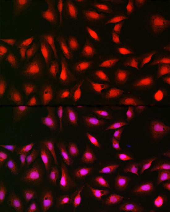 p70 S6 Kinase 1 Rabbit pAb