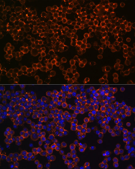 IFNGR1 Rabbit mAb
