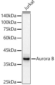 [KD Validated] Aurora B Rabbit mAb