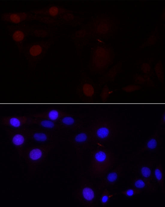 [KD Validated] Aurora B Rabbit mAb