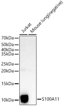 S100A11 Rabbit pAb