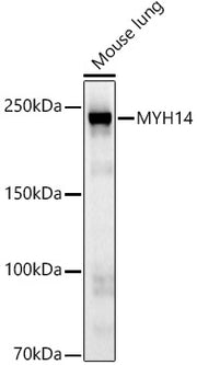 MYH14 Rabbit mAb