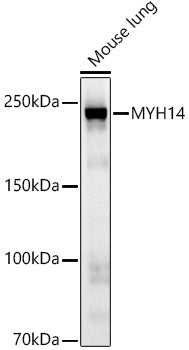MYH14 Rabbit mAb