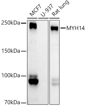 MYH14 Rabbit mAb