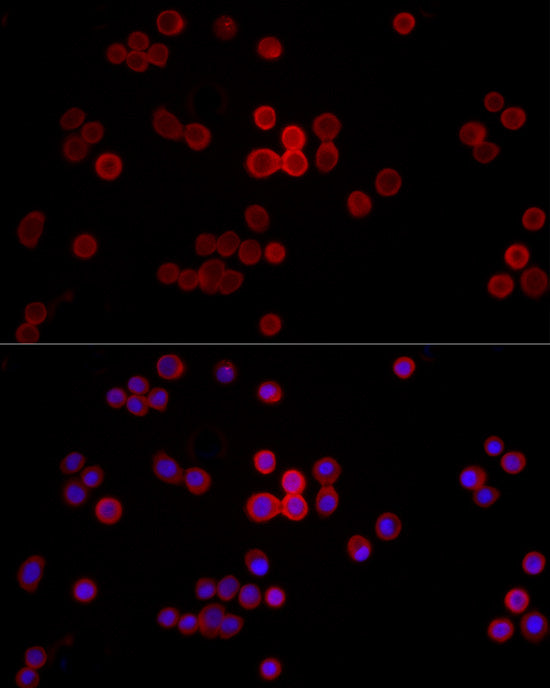 MYH14 Rabbit mAb
