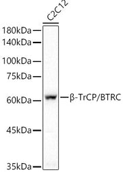 β-TrCP/BTRC Rabbit mAb