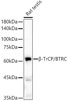 β-TrCP/BTRC Rabbit mAb