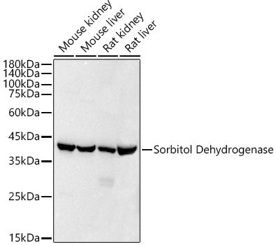 Sorbitol Dehydrogenase Rabbit mAb