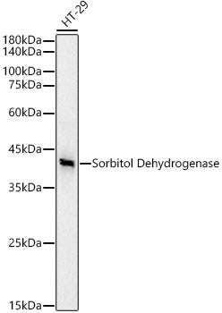 Sorbitol Dehydrogenase Rabbit mAb
