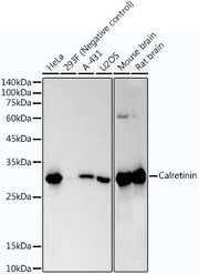 Calretinin Rabbit mAb