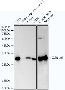 Calretinin Rabbit mAb