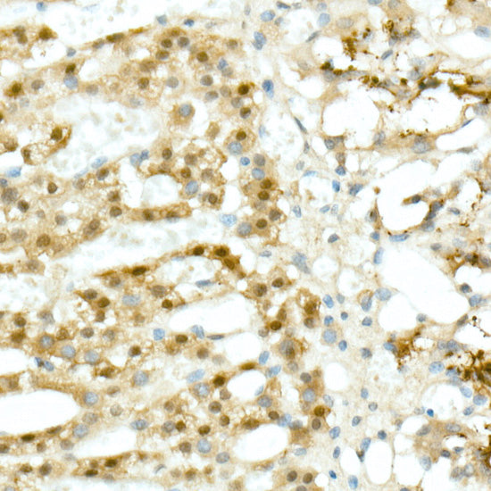 Calretinin Rabbit mAb