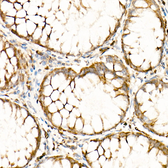 Calretinin Rabbit mAb