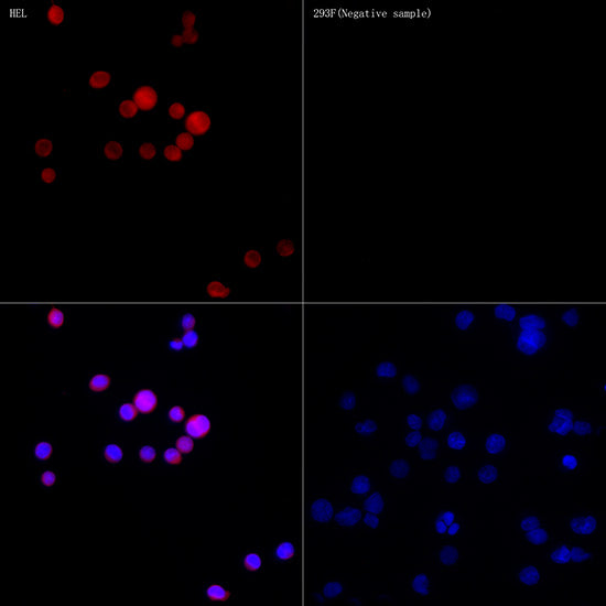 Calretinin Rabbit mAb