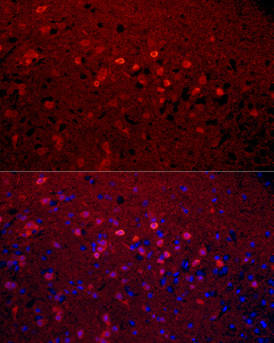 Calretinin Rabbit mAb