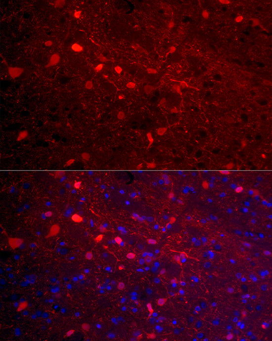 Calretinin Rabbit mAb
