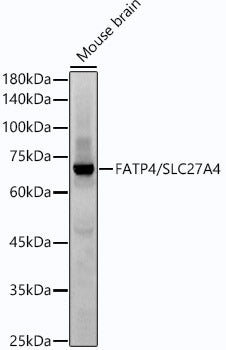 FATP4/SLC27A4 Rabbit mAb
