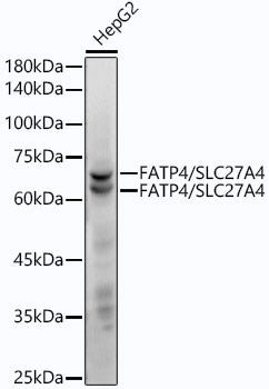FATP4/SLC27A4 Rabbit mAb