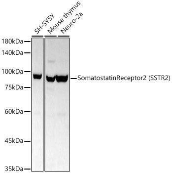 Somatostatin Receptor 2 (SSTR2) Rabbit mAb