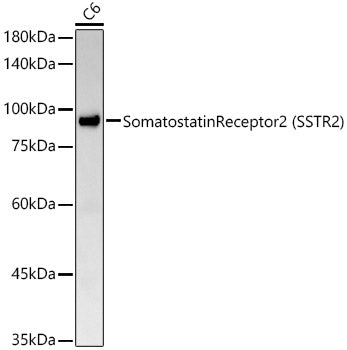 Somatostatin Receptor 2 (SSTR2) Rabbit mAb