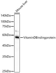 Vitamin D Binding protein Rabbit mAb