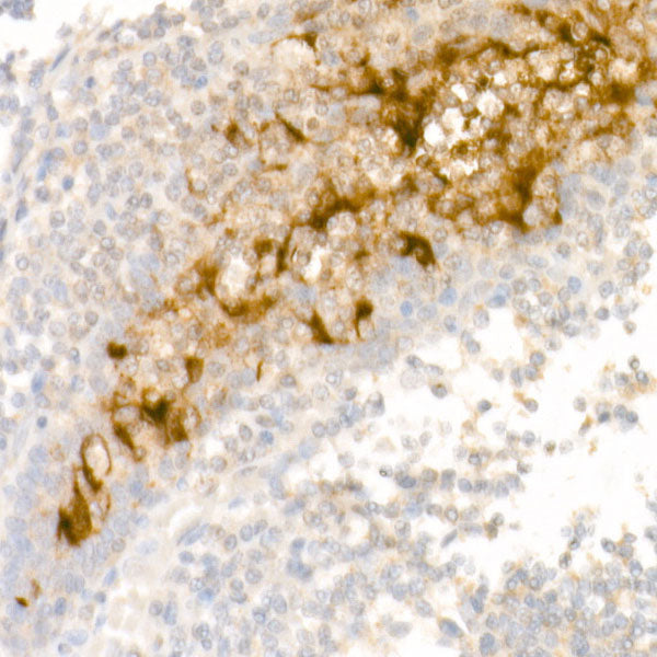 Mesothelin Rabbit mAb