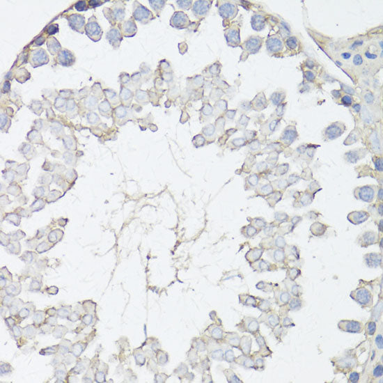 MRP4/ABCC4 Rabbit pAb