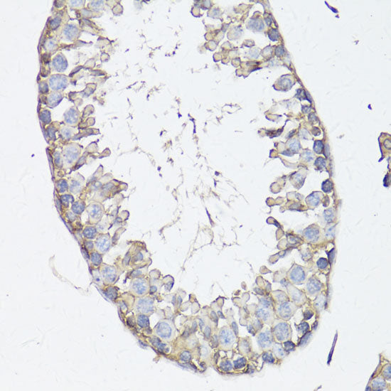 MRP4/ABCC4 Rabbit pAb