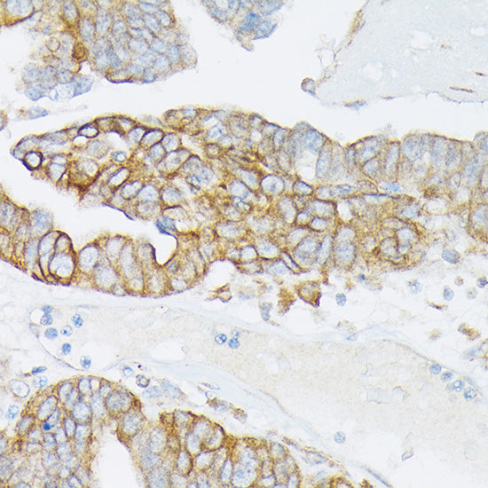 MRP4/ABCC4 Rabbit pAb