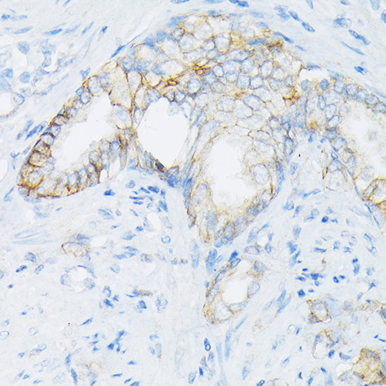 MRP4/ABCC4 Rabbit pAb