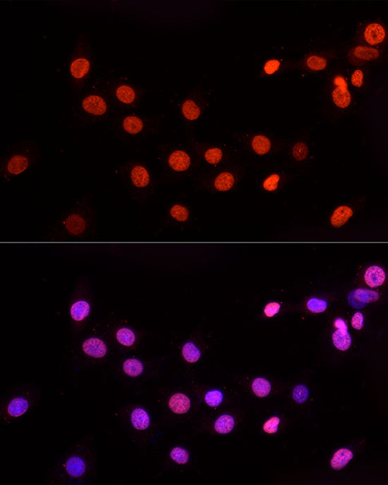 TriMethyl-Histone H3-K27 Rabbit mAb