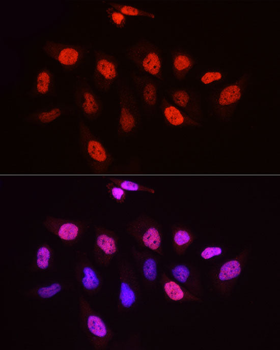 TriMethyl-Histone H3-K27 Rabbit mAb