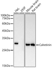 Calretinin Rabbit mAb