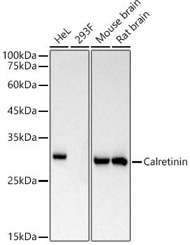 Calretinin Rabbit mAb