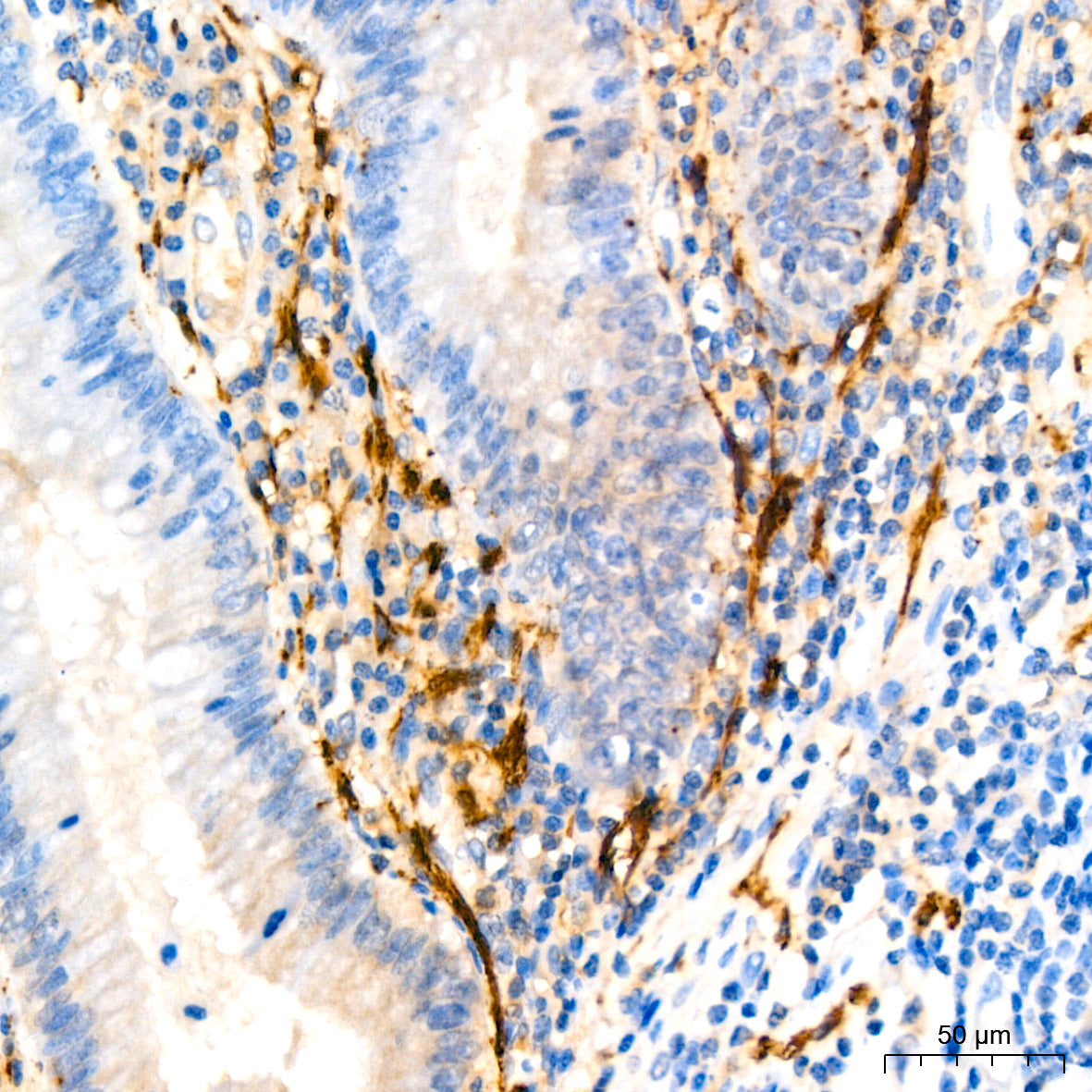Calretinin Rabbit mAb