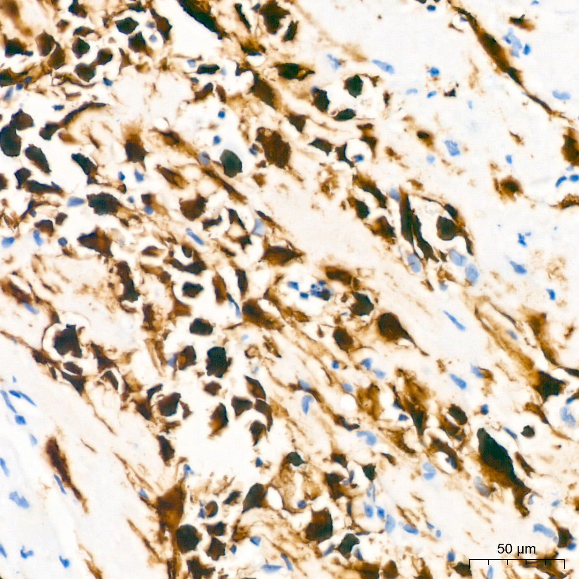 Calretinin Rabbit mAb