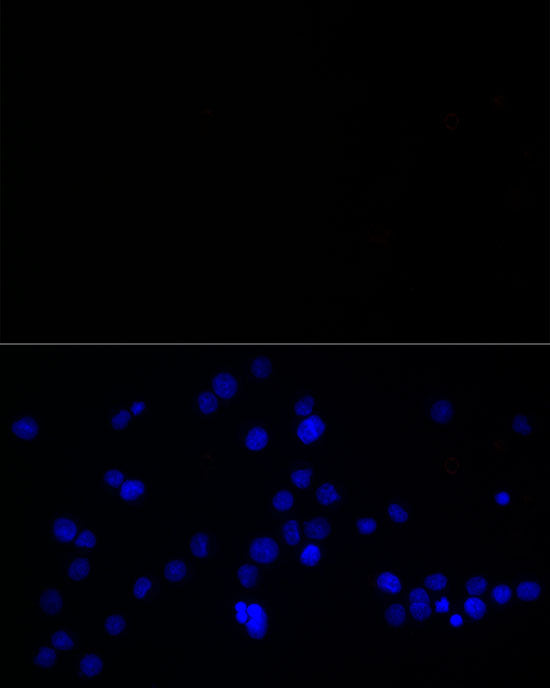 Calretinin Rabbit mAb