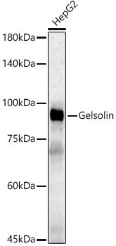 [KD Validated] Gelsolin Rabbit pAb