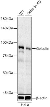 [KD Validated] Gelsolin Rabbit pAb