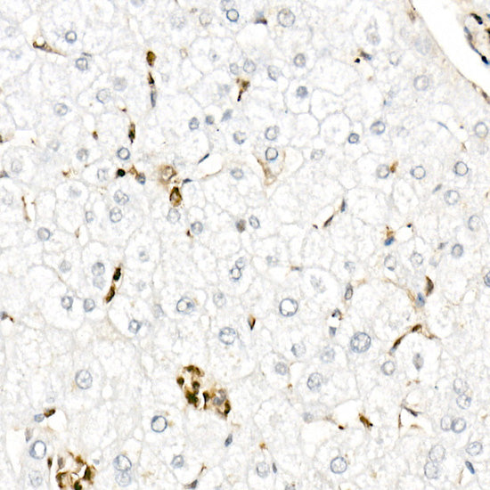 [KD Validated] Gelsolin Rabbit pAb
