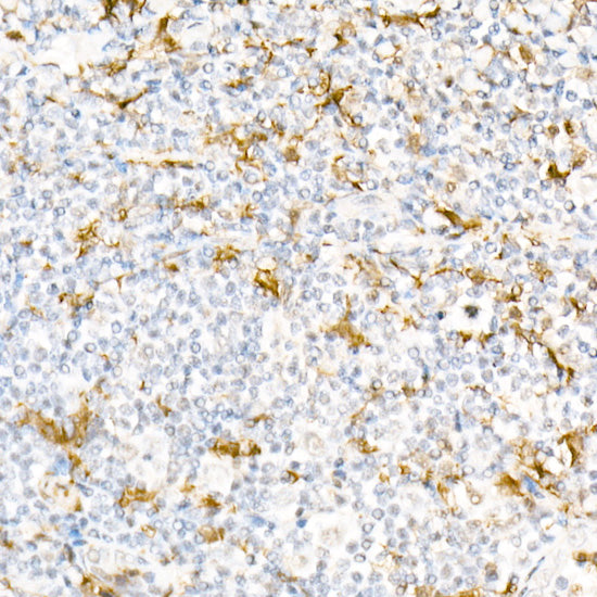 [KD Validated] Gelsolin Rabbit pAb