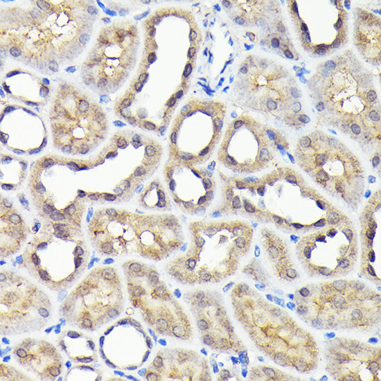 NADPH oxidase 4 (NOX4) Rabbit pAb
