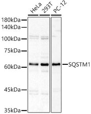 SQSTM1 Rabbit pAb