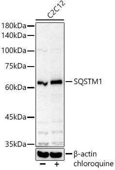 SQSTM1 Rabbit pAb